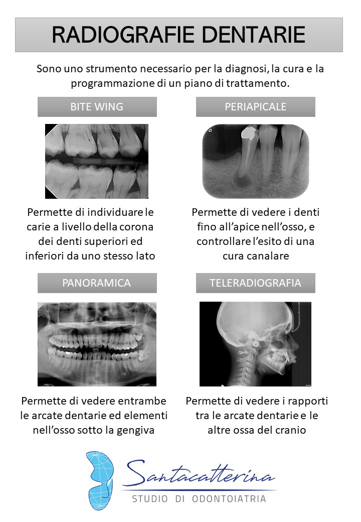 radiografie.jpg