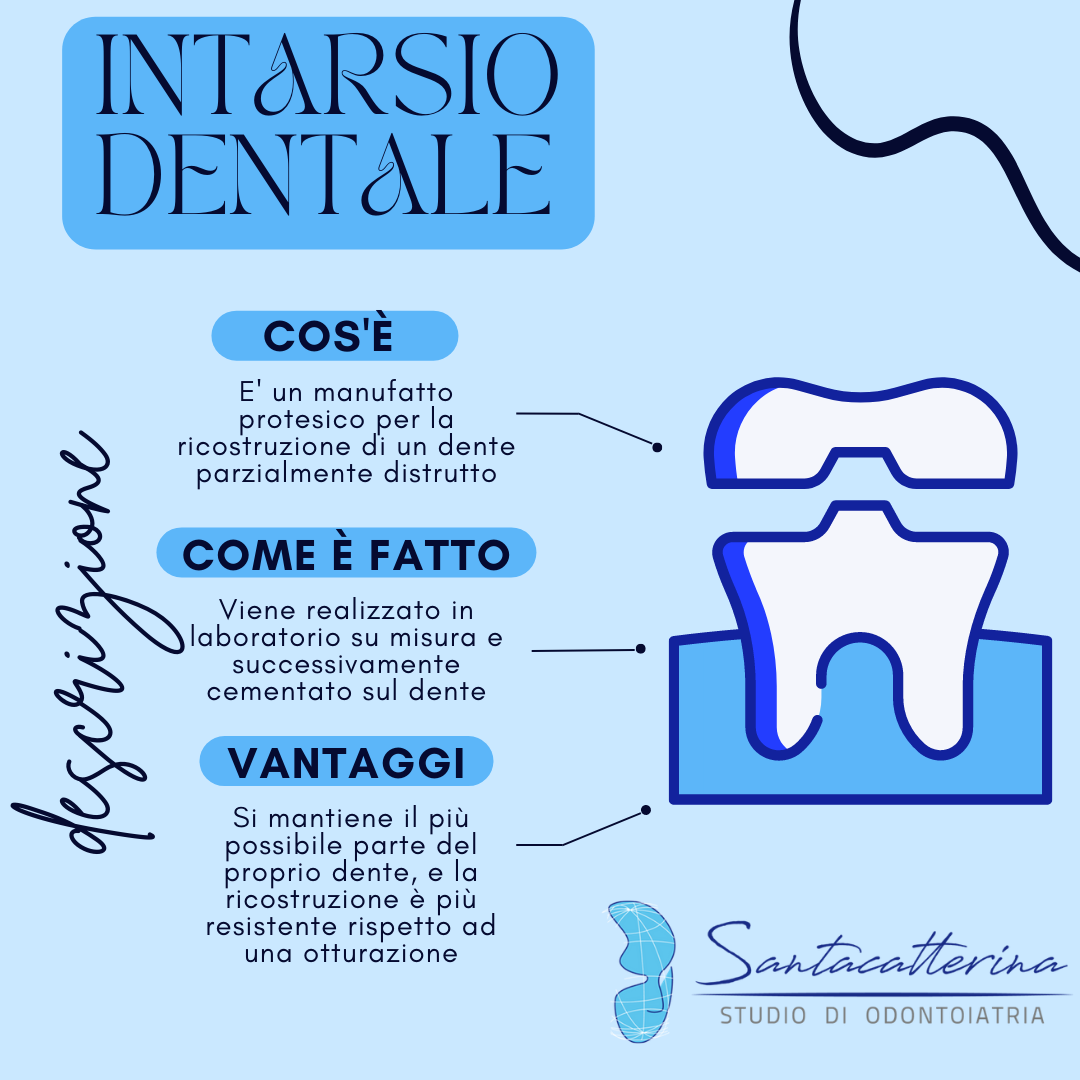 Intarsio-dentale.png